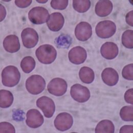 platelet-rich plasma cells