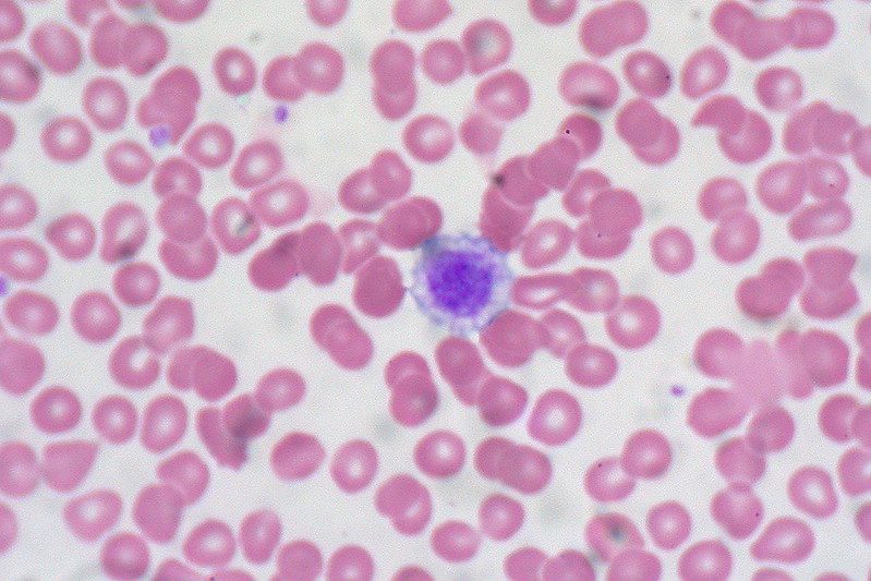 Microscopic image showing red blood cells with one platelet visible