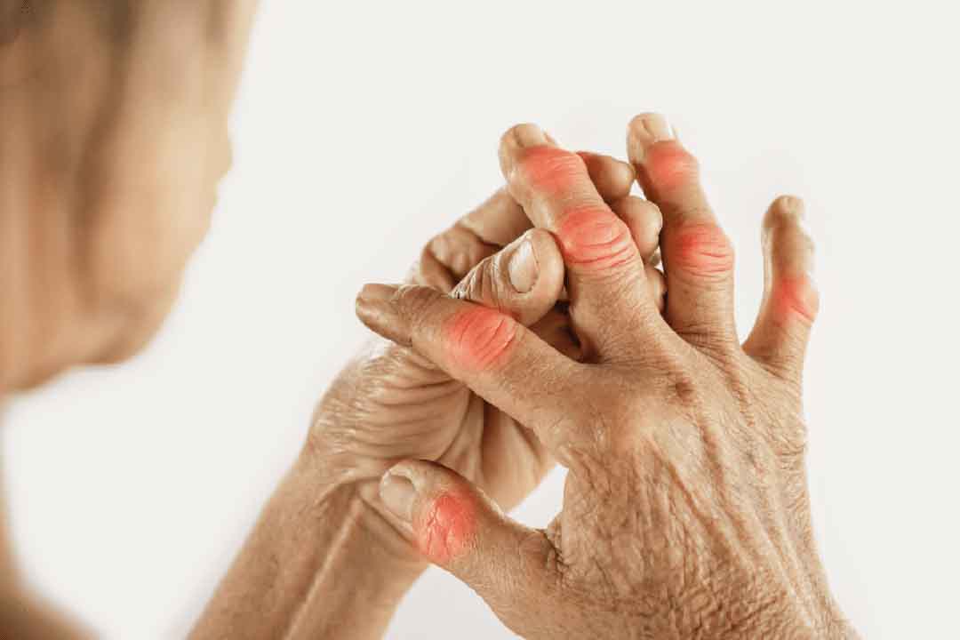 chronic inflammation