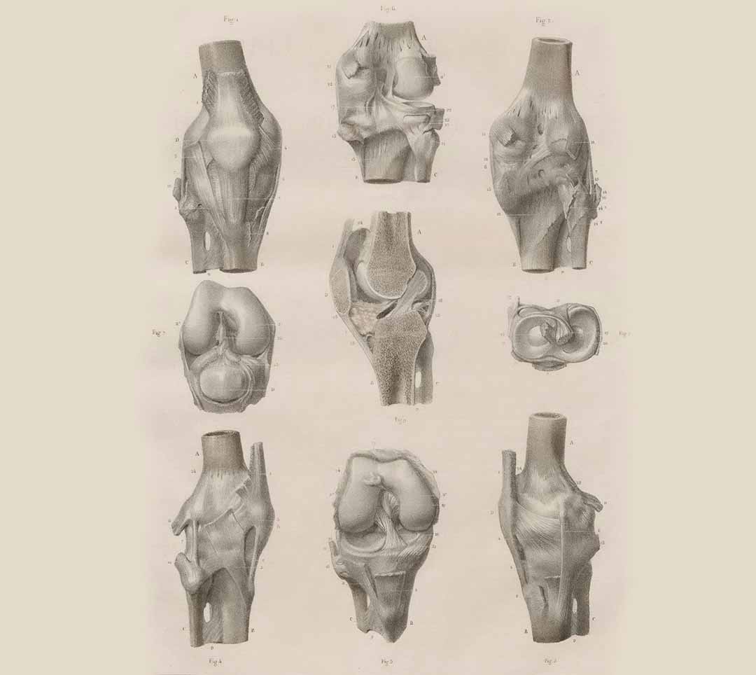 X-ray image of human knee