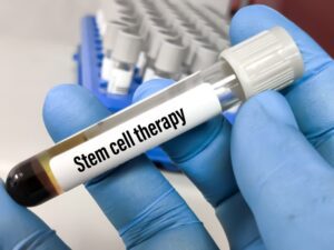 stem cell therapy tube