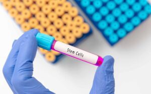 test tube with stem cells